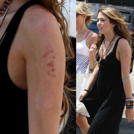 MILEY SE QUEMA LA PIEL CON EL SOL