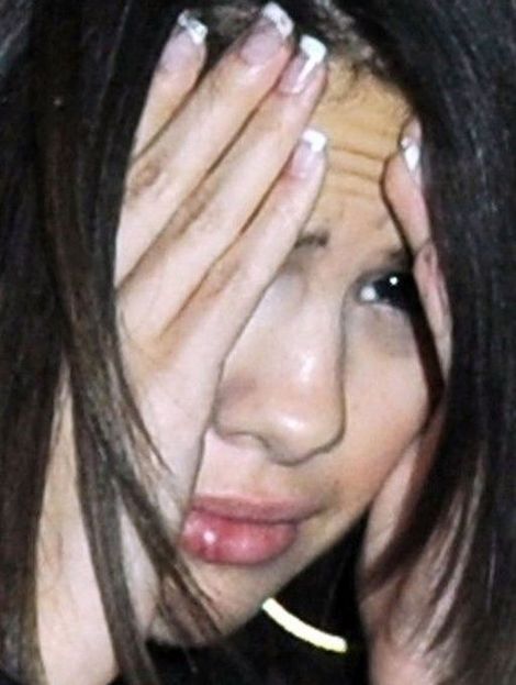 fotos de mujeres golpeadas por su pareja